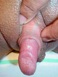 femme-gros-clitoris-2-180x240.jpg