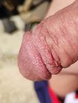 gland.jpg