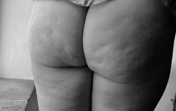 fesses